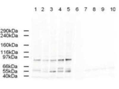 Western Blot: AP2A2 Antibody [NBP2-21648]